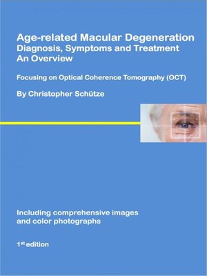 cover image of Age-related macular degeneration